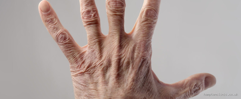 Are Your Hands the First Thing to Age? Here's What You Need to Know