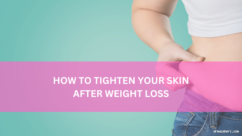 How Long Does It Take for Skin to Tighten After Weight Loss?