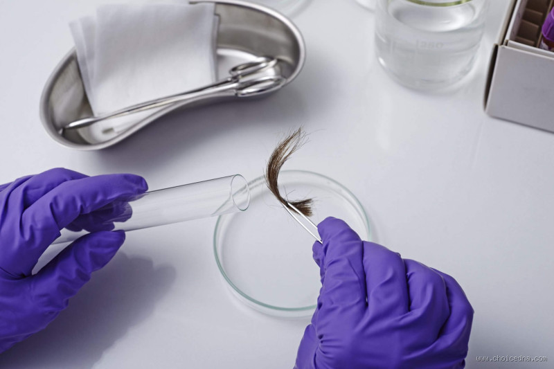 What Is the DNA Test for Baldness? Uncover the Truth Behind Hair Loss