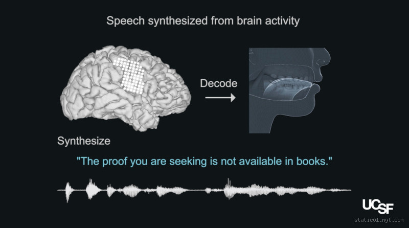 What Part of the Brain Causes Speech Delay? Uncovering the Hidden Reasons