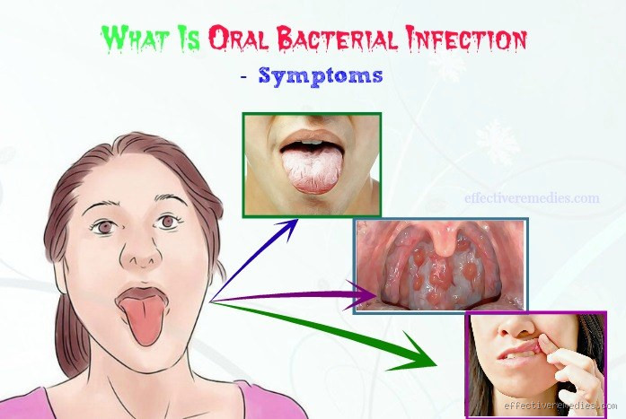 When is a Mouth Infection Serious? What You Need to Know