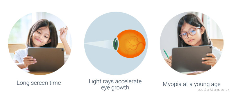 How Much Screen Time Is OK for Myopia?