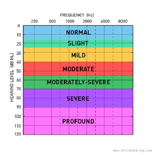 What is the Normal Hearing Range for Humans? Understanding Your Ears' Limits