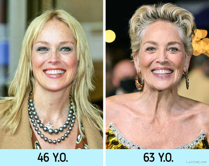 Which Faces Age Well? Traits That Stay Beautiful Over Time