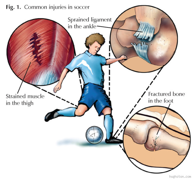 How Often Are Soccer Players Actually Hurt? The Truth Behind Injuries